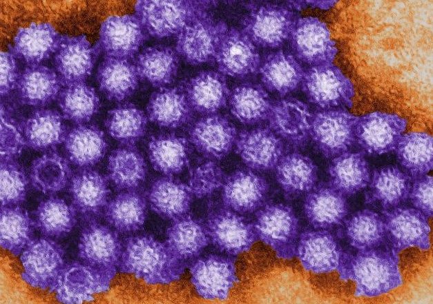 諾羅病毒飲食禁忌 諾羅病毒飲食禁忌