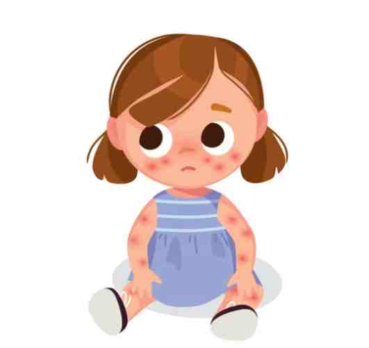 過敏不能吃的食物 過敏不能吃的食物