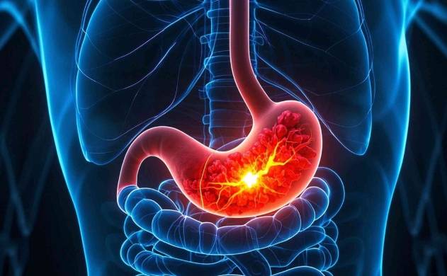 胃炎飲食禁忌 胃炎飲食禁忌