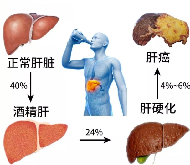 酒精代謝計算 酒精代謝計算