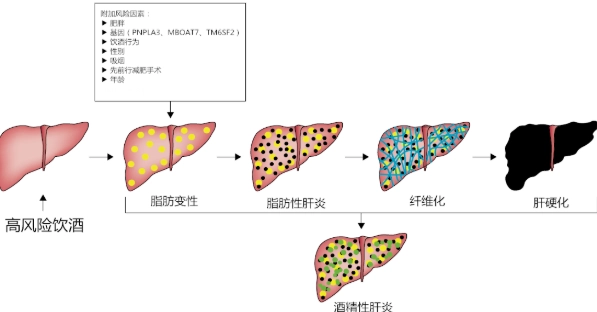 肝臟健康 肝臟健康
