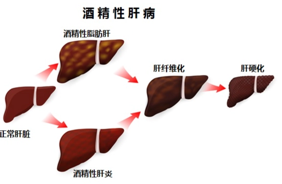 酒精代謝計算 酒精代謝計算