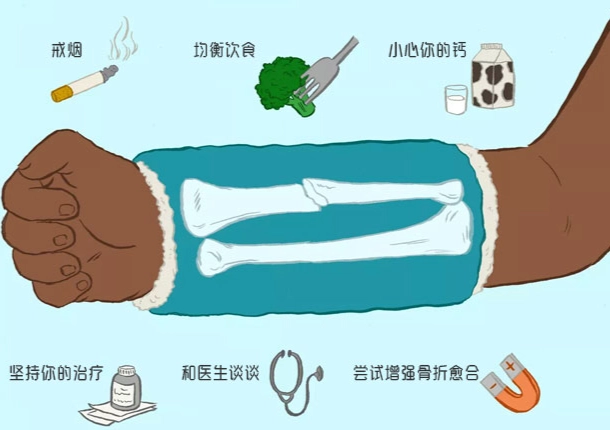 肋骨骨折恢復飲食