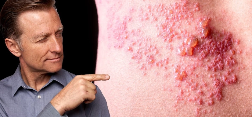 皮蛇飲食禁忌 皮蛇飲食禁忌