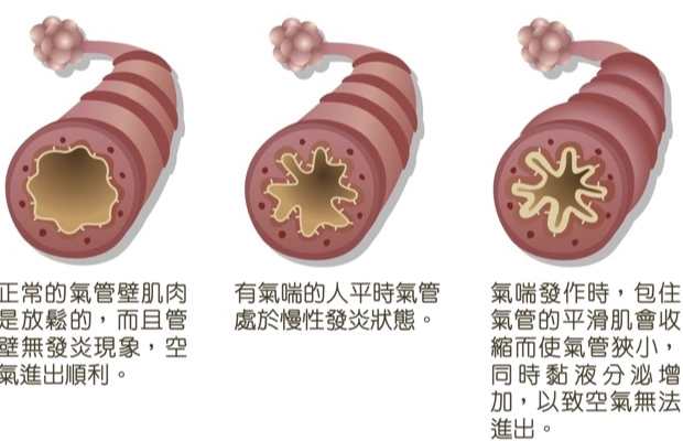 氣喘潤肺湯食譜
