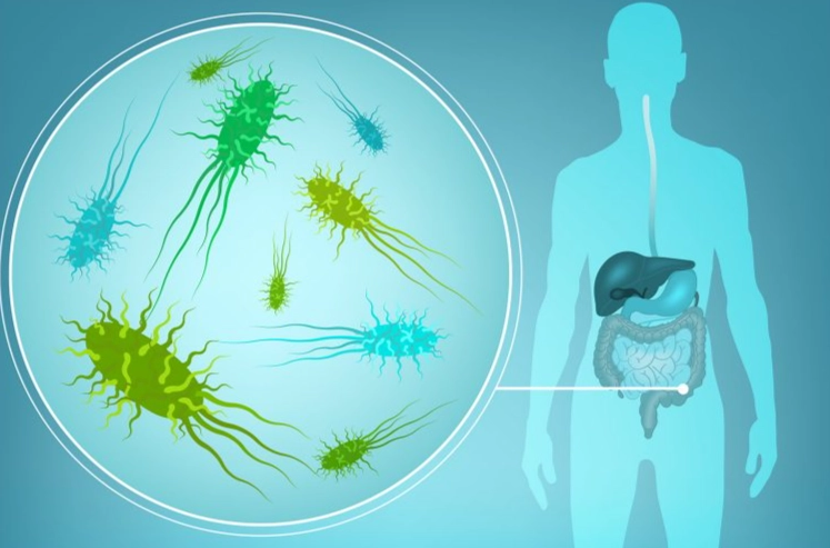 嚴重便秘益生菌推薦：解決腸道問題的實用選擇指南