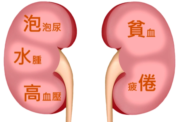 腎臟病第四期會好嗎