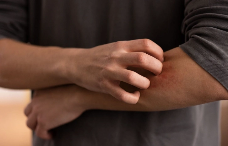 床蝨怕什麼精油